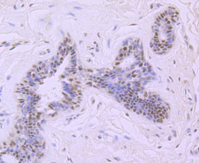 MRE11 Antibody in Immunohistochemistry (Paraffin) (IHC (P))