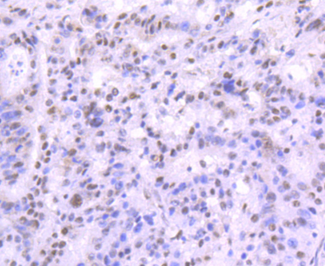 MRE11 Antibody in Immunohistochemistry (Paraffin) (IHC (P))