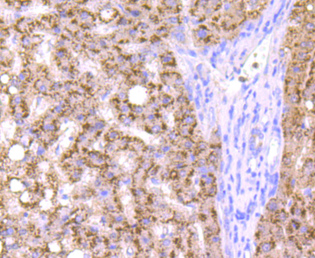 Cathepsin B Antibody in Immunohistochemistry (Paraffin) (IHC (P))