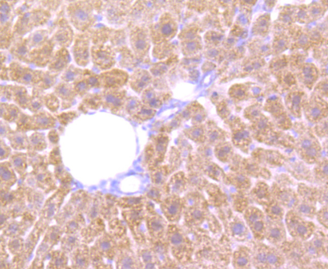 Cathepsin B Antibody in Immunohistochemistry (Paraffin) (IHC (P))