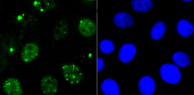 53BP1 Antibody in Immunocytochemistry (ICC/IF)