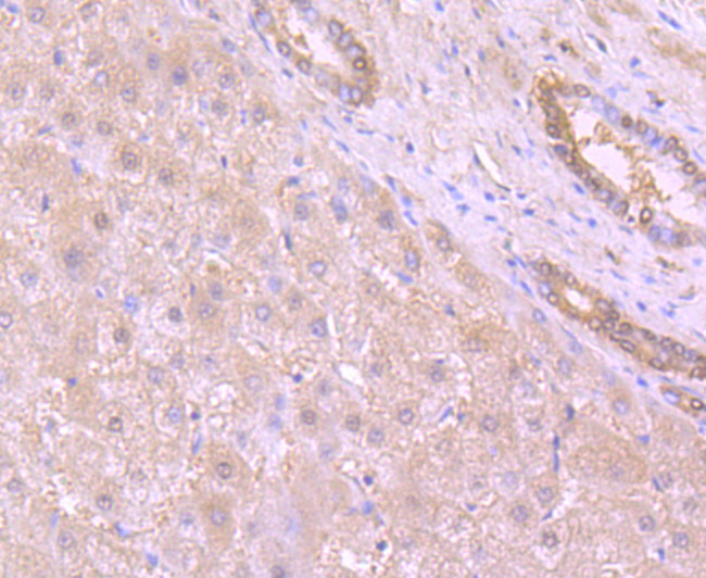 53BP1 Antibody in Immunohistochemistry (Paraffin) (IHC (P))