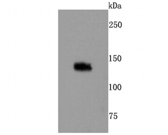 TLR7 Antibody in Western Blot (WB)