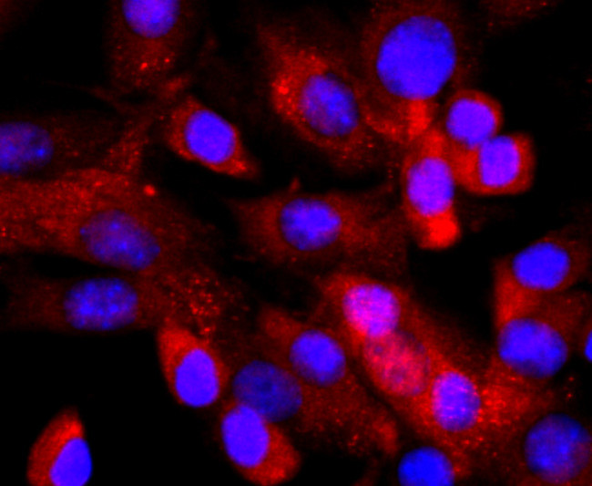 NFATC2 Antibody in Immunocytochemistry (ICC/IF)