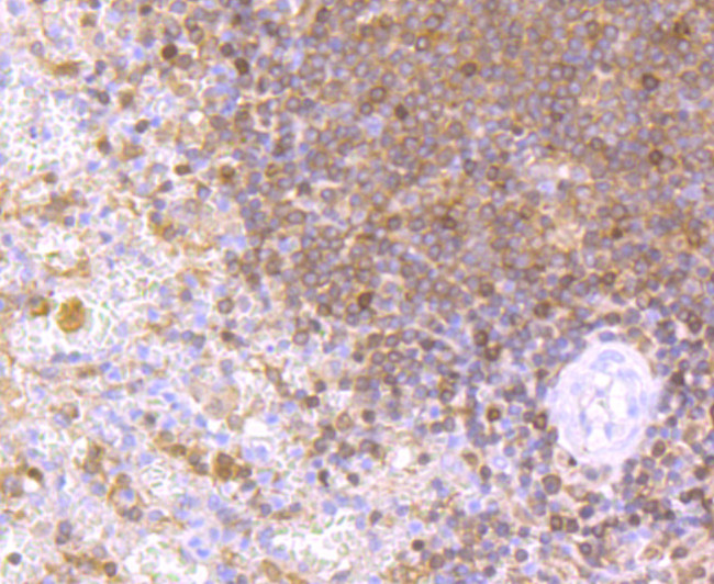 NFATC2 Antibody in Immunohistochemistry (Paraffin) (IHC (P))