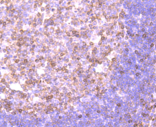 NFATC2 Antibody in Immunohistochemistry (Paraffin) (IHC (P))