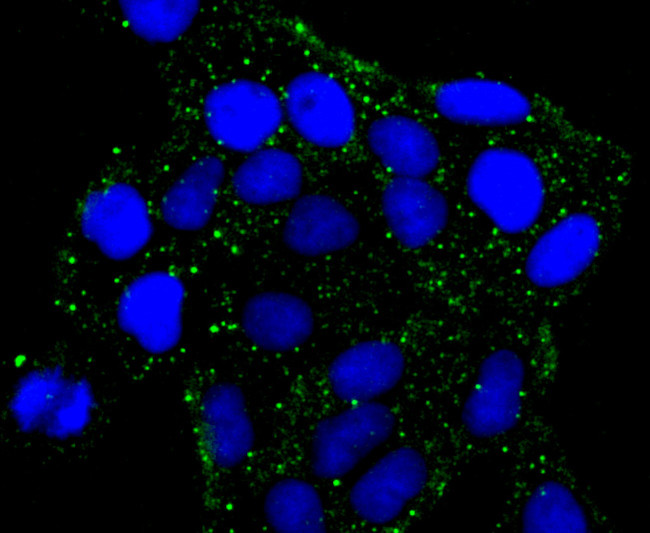 PRKAR2B Antibody in Immunocytochemistry (ICC/IF)