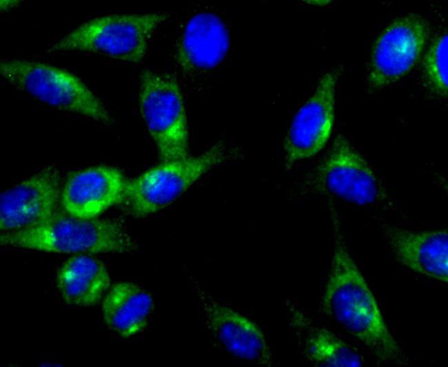 PRKAR2B Antibody in Immunocytochemistry (ICC/IF)