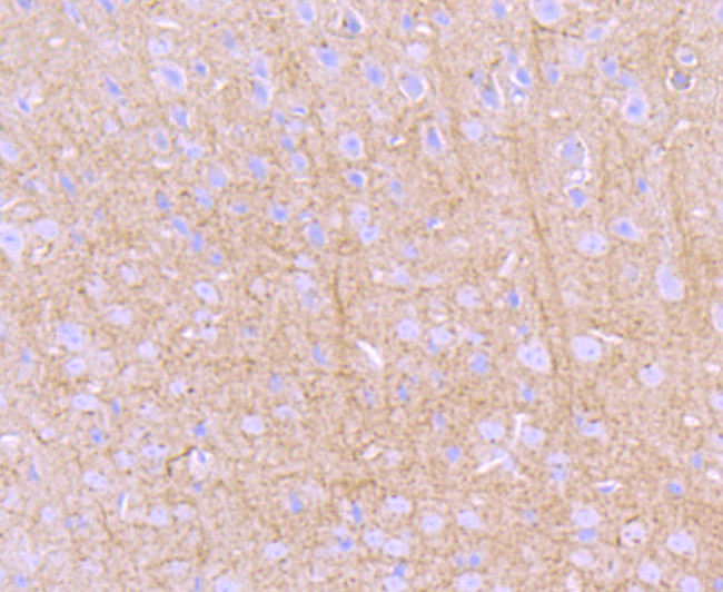 PRKAR2B Antibody in Immunohistochemistry (Paraffin) (IHC (P))