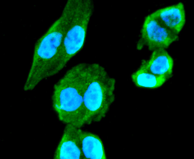 ChAT Antibody in Immunocytochemistry (ICC/IF)