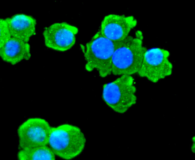 ChAT Antibody in Immunocytochemistry (ICC/IF)