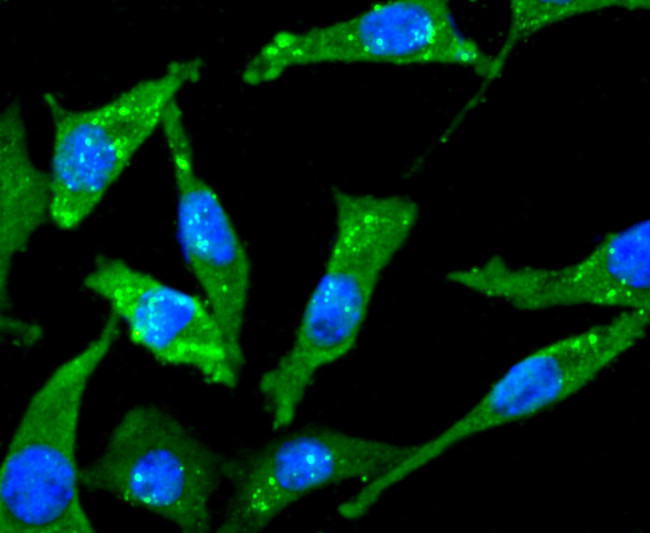 ChAT Antibody in Immunocytochemistry (ICC/IF)