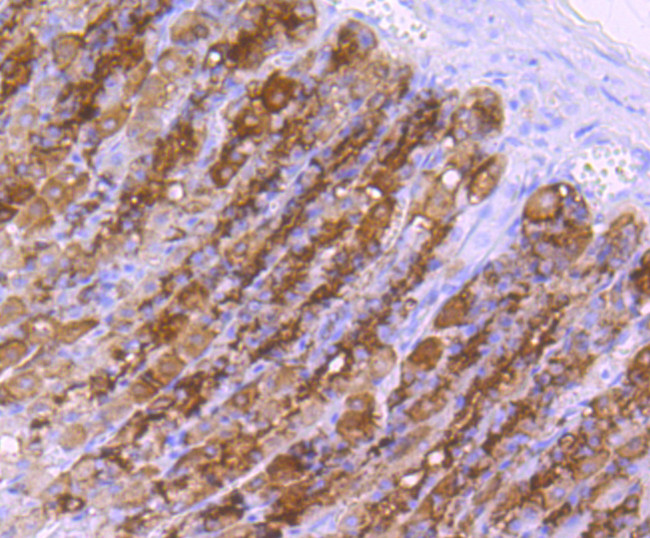 ChAT Antibody in Immunohistochemistry (Paraffin) (IHC (P))