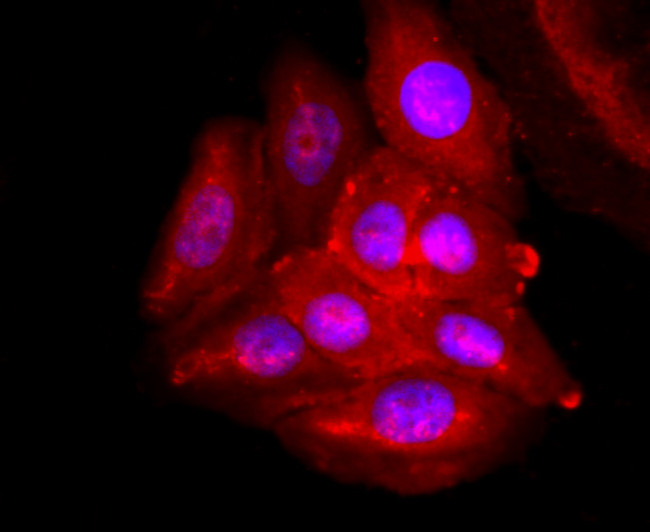 ADFP Antibody in Immunocytochemistry (ICC/IF)