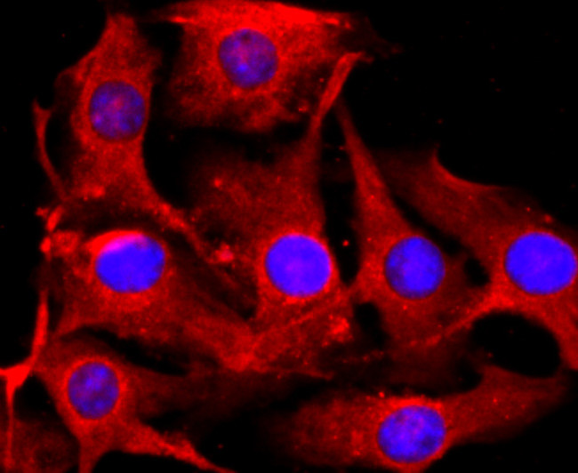 Tyrosinase Antibody in Immunocytochemistry (ICC/IF)