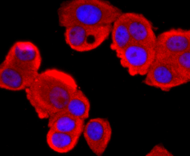 Tyrosinase Antibody in Immunocytochemistry (ICC/IF)