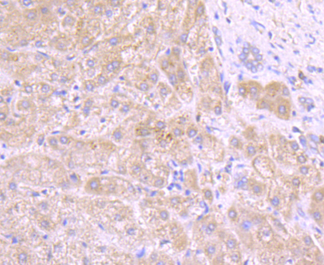 Tyrosinase Antibody in Immunohistochemistry (Paraffin) (IHC (P))