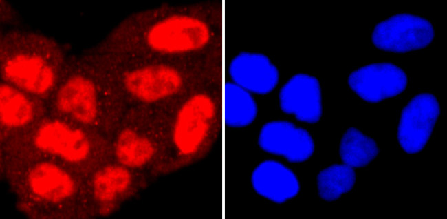 PRMT1 Antibody in Immunocytochemistry (ICC/IF)