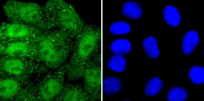 PRMT1 Antibody in Immunocytochemistry (ICC/IF)