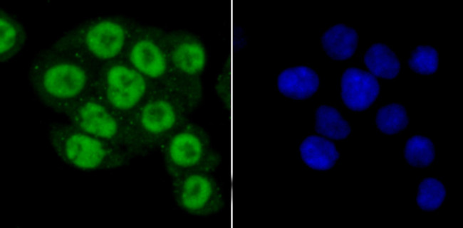 PRMT1 Antibody in Immunocytochemistry (ICC/IF)