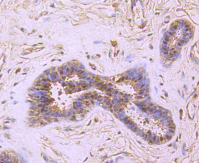 PRMT1 Antibody in Immunohistochemistry (Paraffin) (IHC (P))