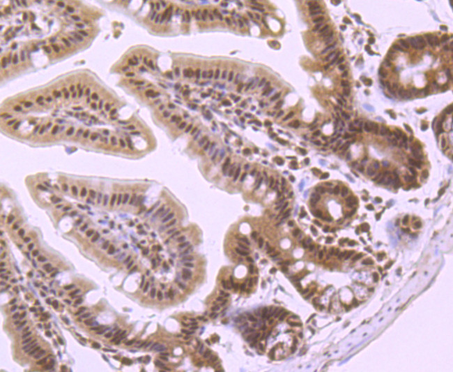 PRMT1 Antibody in Immunohistochemistry (Paraffin) (IHC (P))