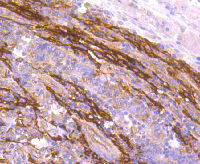 FAP Antibody in Immunohistochemistry (Paraffin) (IHC (P))