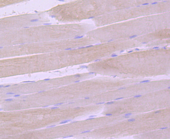 SGCG Antibody in Immunohistochemistry (Paraffin) (IHC (P))