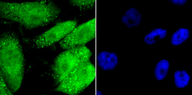 Gata-4 Antibody in Immunocytochemistry (ICC/IF)