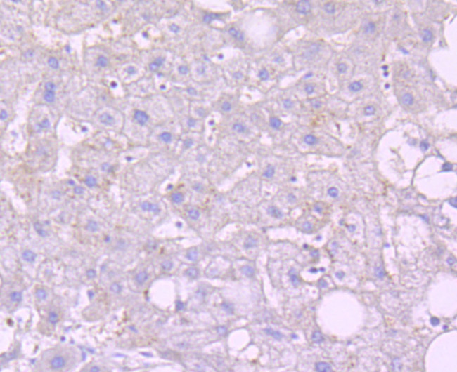 NOXA Antibody in Immunohistochemistry (Paraffin) (IHC (P))