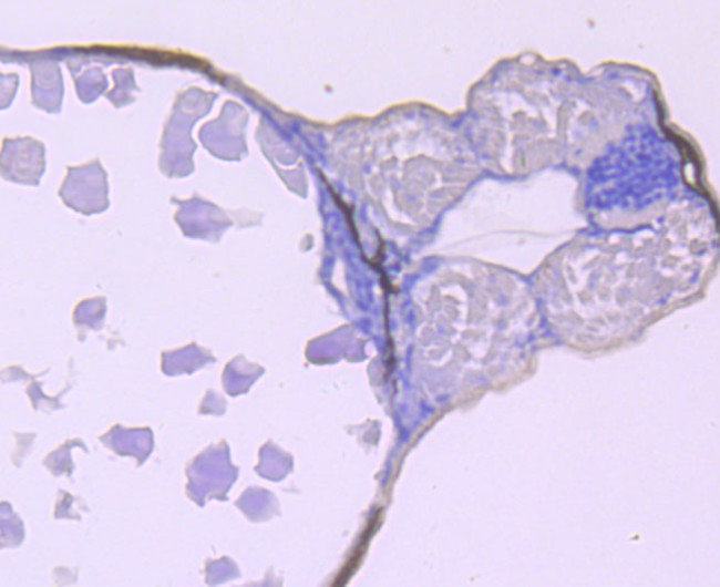 CaMKII delta Antibody in Immunohistochemistry (Paraffin) (IHC (P))