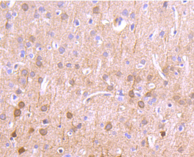 CaMKII delta Antibody in Immunohistochemistry (Paraffin) (IHC (P))