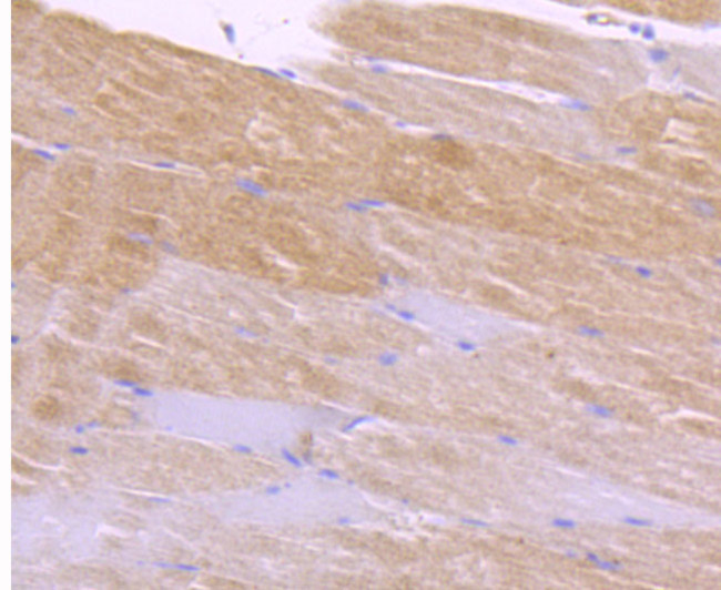 CaMKII delta Antibody in Immunohistochemistry (Paraffin) (IHC (P))