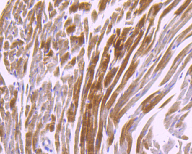 CaMKII delta Antibody in Immunohistochemistry (Paraffin) (IHC (P))