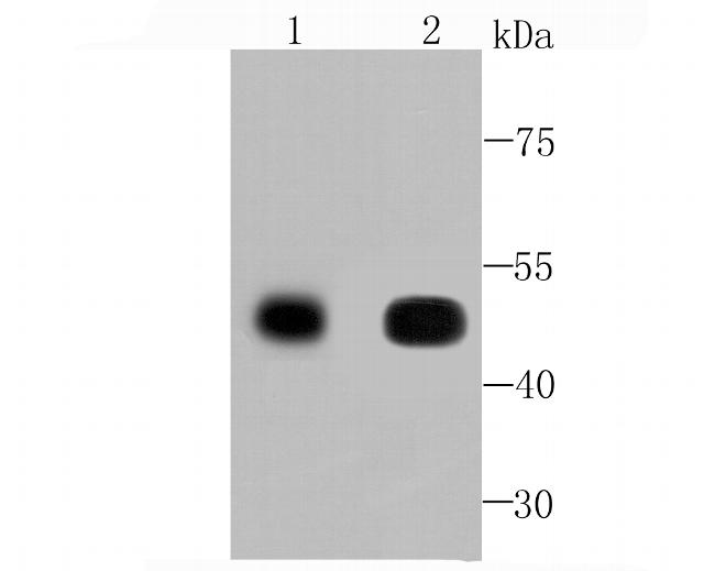 CaMKII delta Antibody in Western Blot (WB)