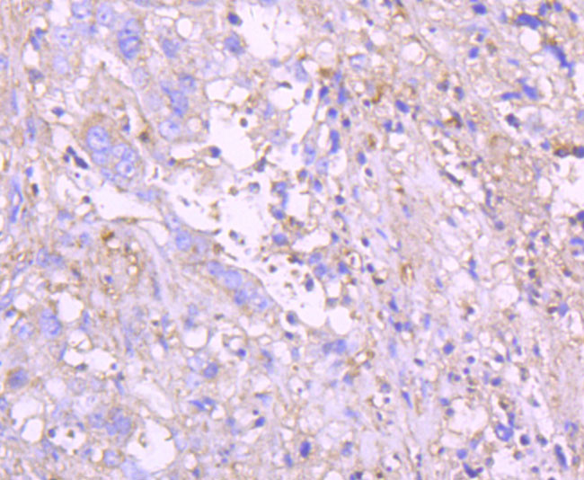 G6PD Antibody in Immunohistochemistry (Paraffin) (IHC (P))