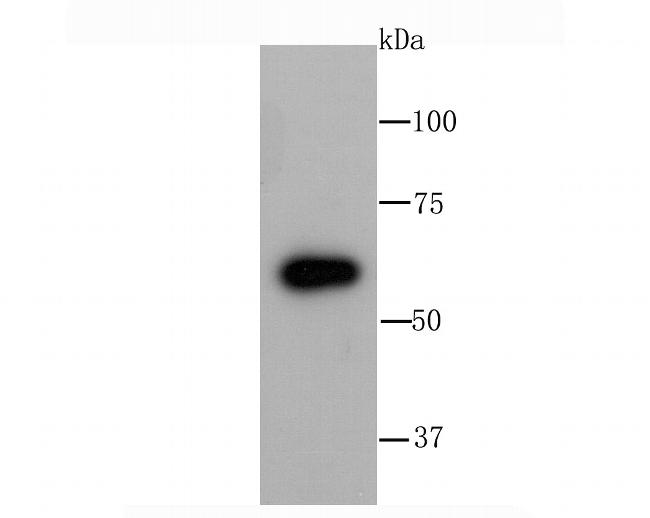 G6PD Antibody in Western Blot (WB)