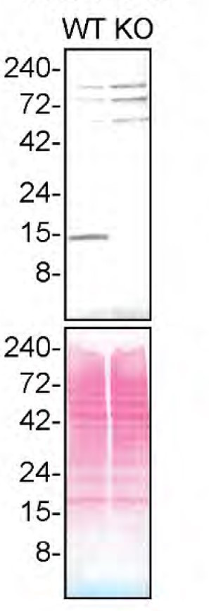 Profilin 1 Antibody
