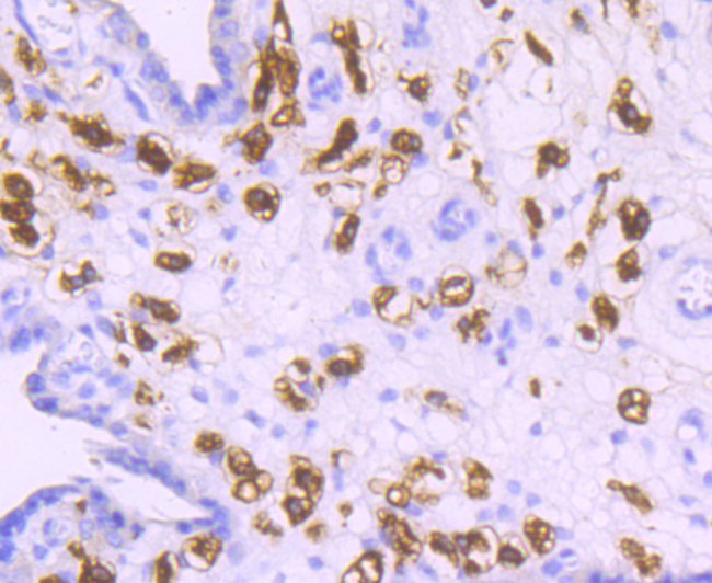 CD163 Antibody in Immunohistochemistry (Paraffin) (IHC (P))