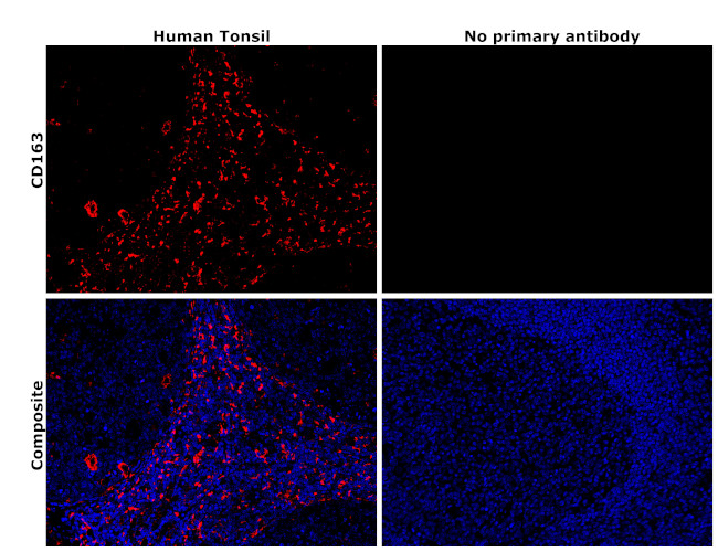 CD163 Antibody in Immunohistochemistry (Paraffin) (IHC (P))