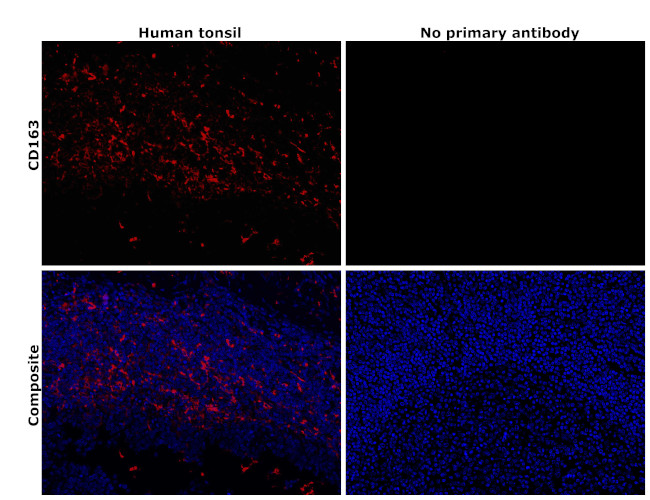 CD163 Antibody in Immunohistochemistry (Paraffin) (IHC (P))