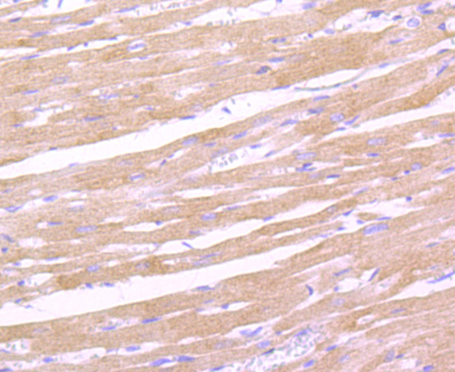 Leptin Receptor Antibody in Immunohistochemistry (Paraffin) (IHC (P))