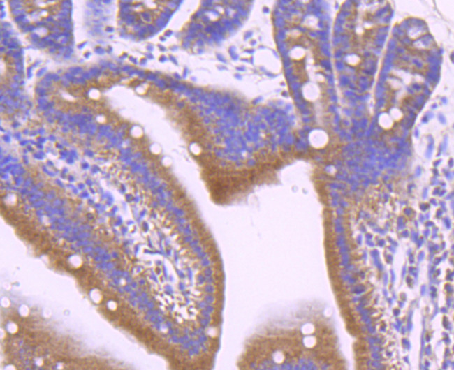 Leptin Receptor Antibody in Immunohistochemistry (Paraffin) (IHC (P))