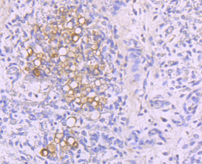 NFATC1 Antibody in Immunohistochemistry (Paraffin) (IHC (P))