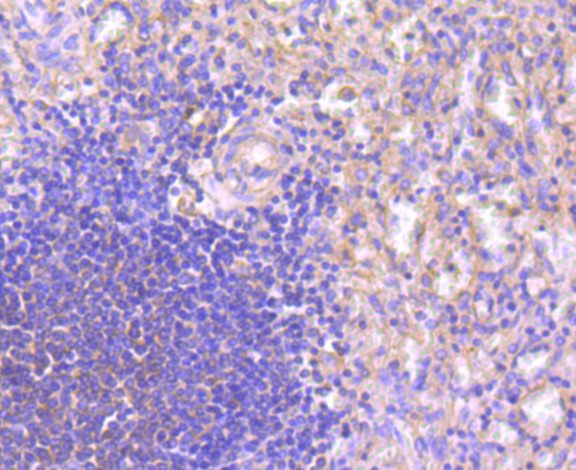 NFATC1 Antibody in Immunohistochemistry (Paraffin) (IHC (P))