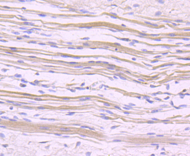 NFATC1 Antibody in Immunohistochemistry (Paraffin) (IHC (P))