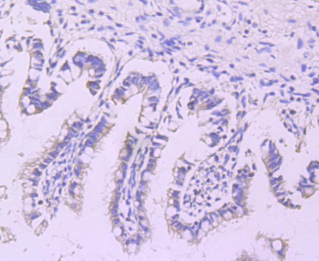 LPL Antibody in Immunohistochemistry (Paraffin) (IHC (P))