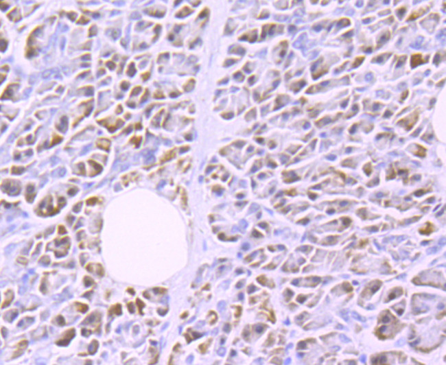 LPL Antibody in Immunohistochemistry (Paraffin) (IHC (P))