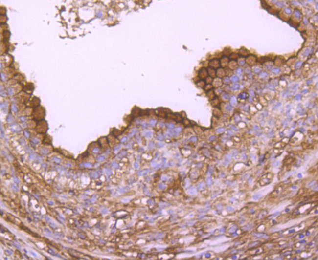 Annexin A2 Antibody in Immunohistochemistry (Paraffin) (IHC (P))