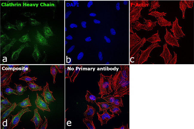 Clathrin Heavy Chain Antibody in Immunocytochemistry (ICC/IF)